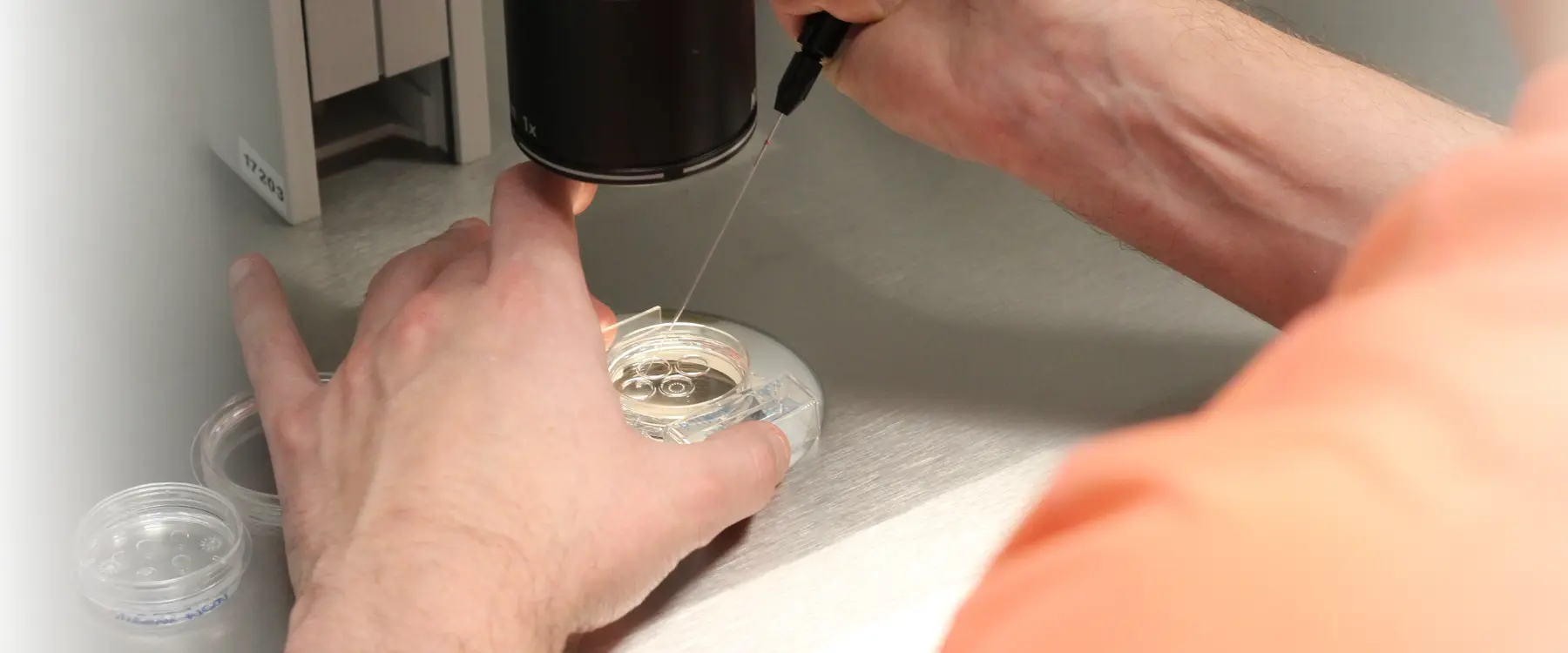 how much do they pay for egg donation in spain