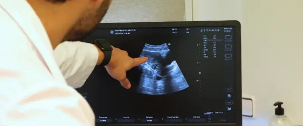 como eliminar miomas